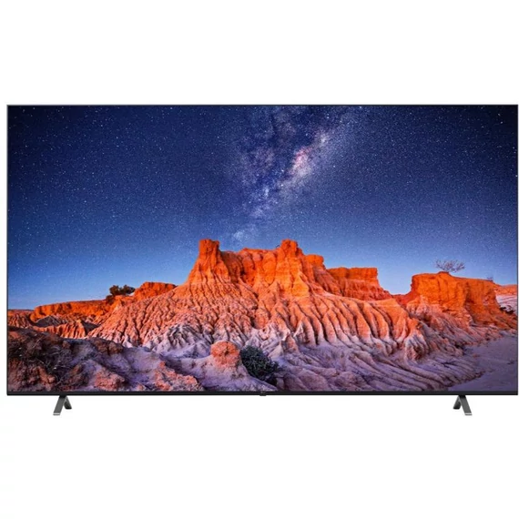LG televízisó 75" UHD 4K smart